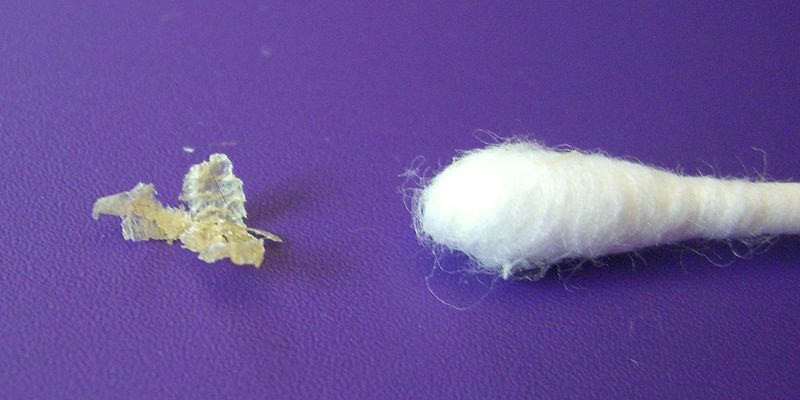 800px-Dry_earwax.jpg